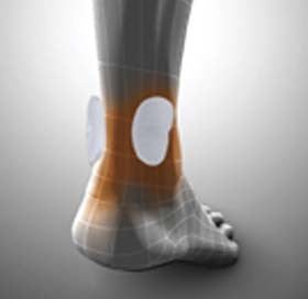 Achillodyn® Sporlastic ortoza za Ahilovu tetivu